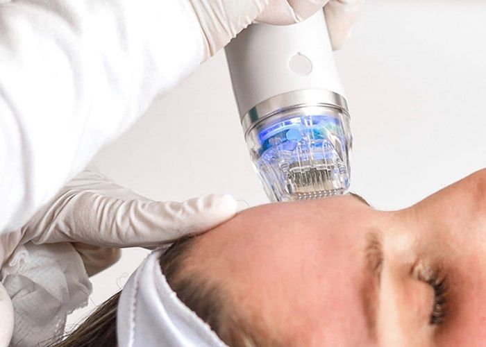 microneedling tunisie