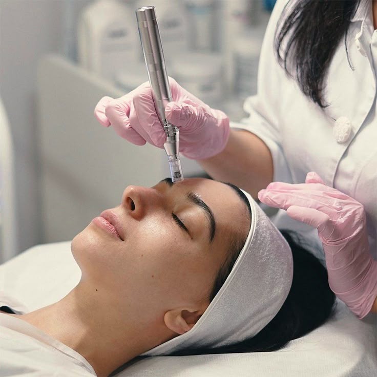 Après une séance de Microneedling + Radiofréquence : les bons gestes à adopter – Conseils Moda Santé