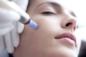microneedling